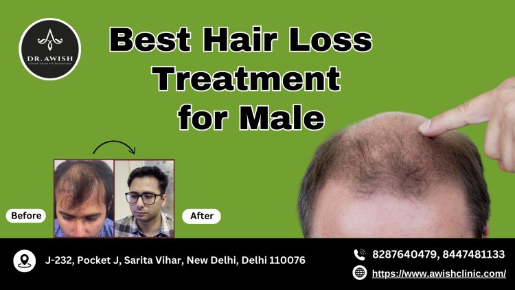 Best Hair Loss Treatments for Men Proven Solutions for Regrowth & Thickness