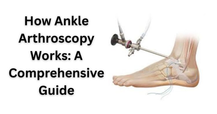 How Ankle Arthroscopy Works: A Comprehensive Guide